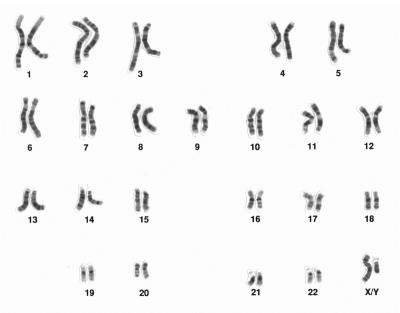 Karyogramm_Mensch_keine Mutation.jpg